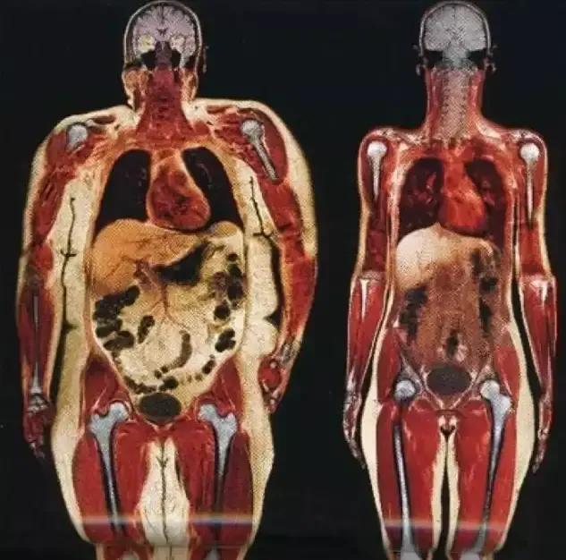 如何让身材变得纤细苗条,身材保持很苗条的女性