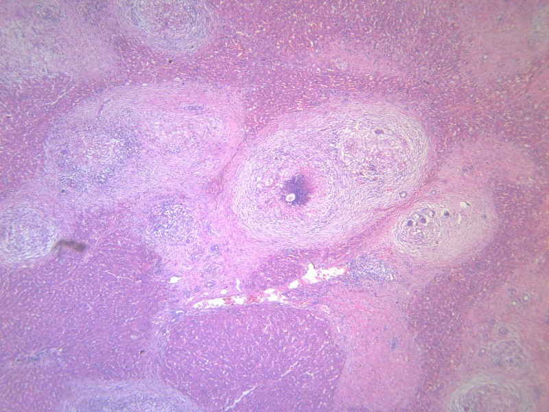 不放弃！为参加儿子婚礼，她坚持抗癌4年重获生机（真实感人）