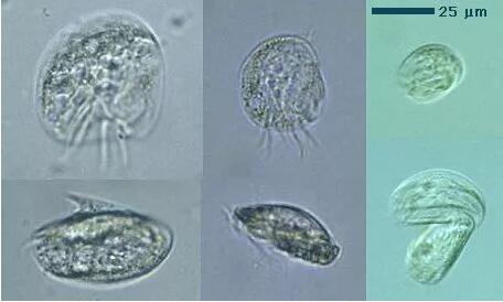 收藏!24种污水处理微生物菌相及指导意义,环保人必看(多图)