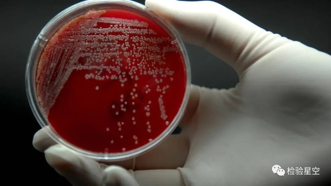 临床标本采集方法及注意事项课件,检验标本的采集要求有哪些