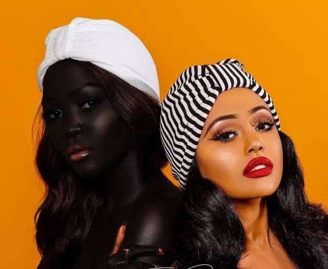 世界上最黑的婴儿眼睛都看不见了,世界上最黑的宝宝现在过的怎么样