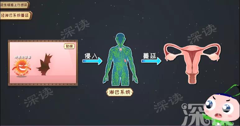输卵管炎是怎么引起的,输卵管炎症消除动画