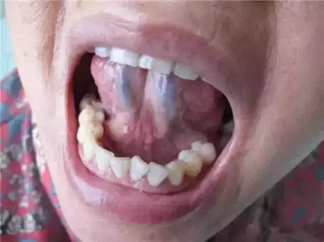 脉象与针灸应用,络脉的治疗作用