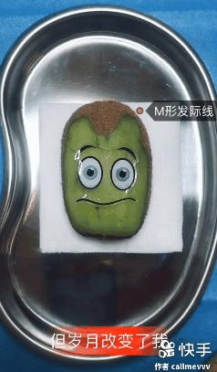 我在快手上看人切洋葱，竟然弄懂了剖腹产？