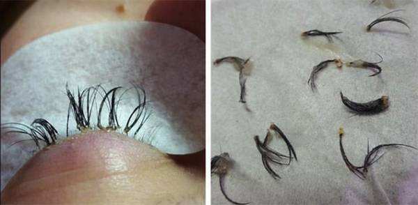 为什么不建议种下睫毛,为什么不要去种睫毛