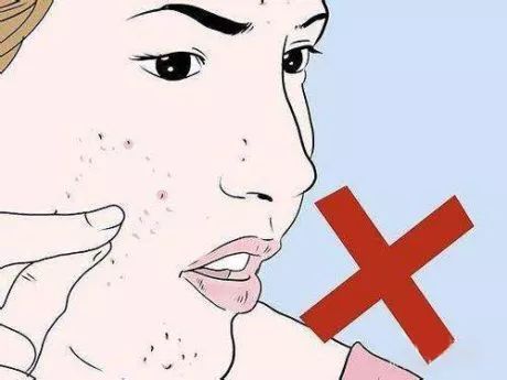 脸上长白色米粒痘痘怎么快速消除,脸上痘痘里面白色米粒是什么东西