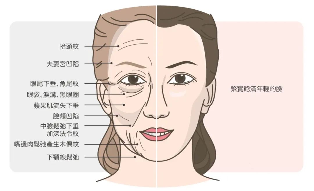 热玛吉法令纹消失了,热玛吉和fotona4d哪个法令纹效果好