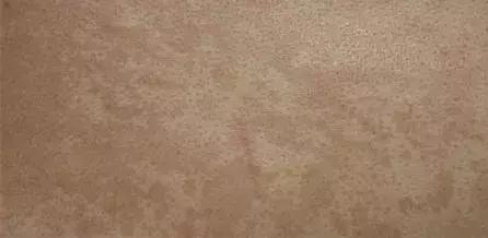 宝宝脸上长白斑可以打预防针吗,宝宝脸上有白斑吃打虫药好吗