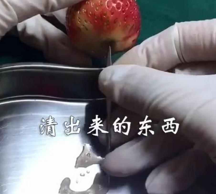 “引产”过程是怎样的？过来人：胎儿有心跳后别打掉，真的很残忍