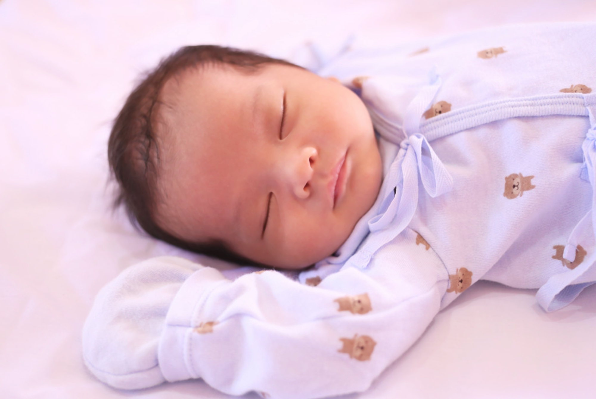 宝宝成为小秃瓢这4个原因要了解,宝宝头发有斑秃是什么原因