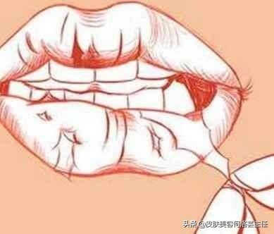 唇色发紫和唇色深,唇色深怎么办四大技巧改善唇色深