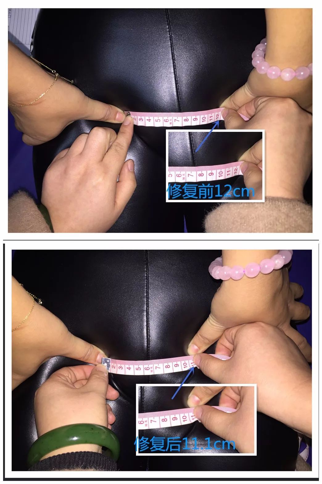 产后骨盆分离能自己恢复吗,产后怎样睡觉姿势对骨盆恢复好