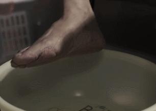 夏天了手脚干裂还有老茧,手脚干裂脱皮老茧用什么药膏