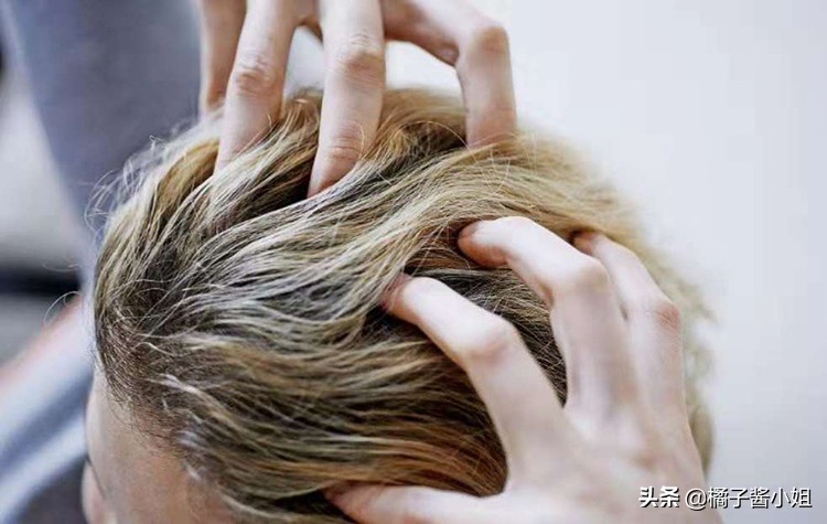 产后头发脱落厉害怎么办,产后头发掉得特别严重怎么调理