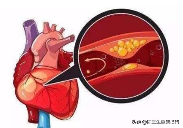 长期吃阿司匹林造成痛风怎么解决,服用阿司匹林肠溶片会引发痛风吗