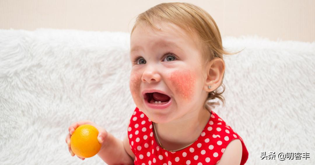 10个月宝宝食物过敏有哪些表现,婴幼儿易过敏的食物有哪些