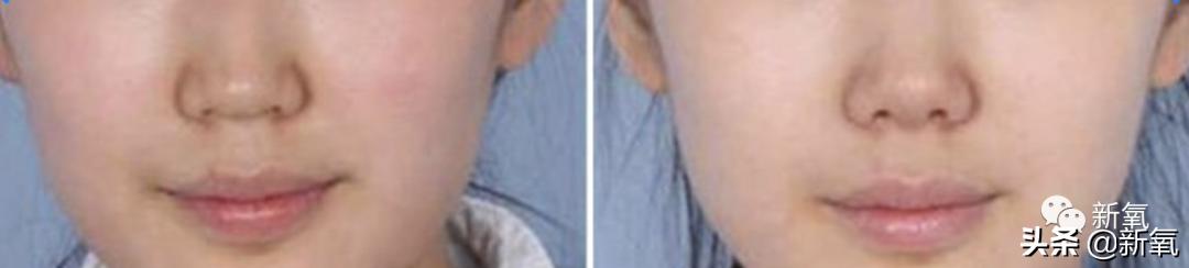 杨超越还能撑多久,杨超越遇到的真实事件