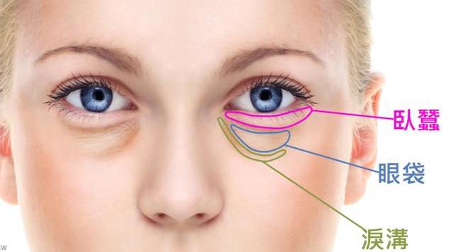 去眼袋小妙招搞笑视频,怎么去眼袋谁有妙招啊