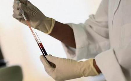 超声聚焦刀可治什么病,子宫腺肌症超声刀治疗怎么样