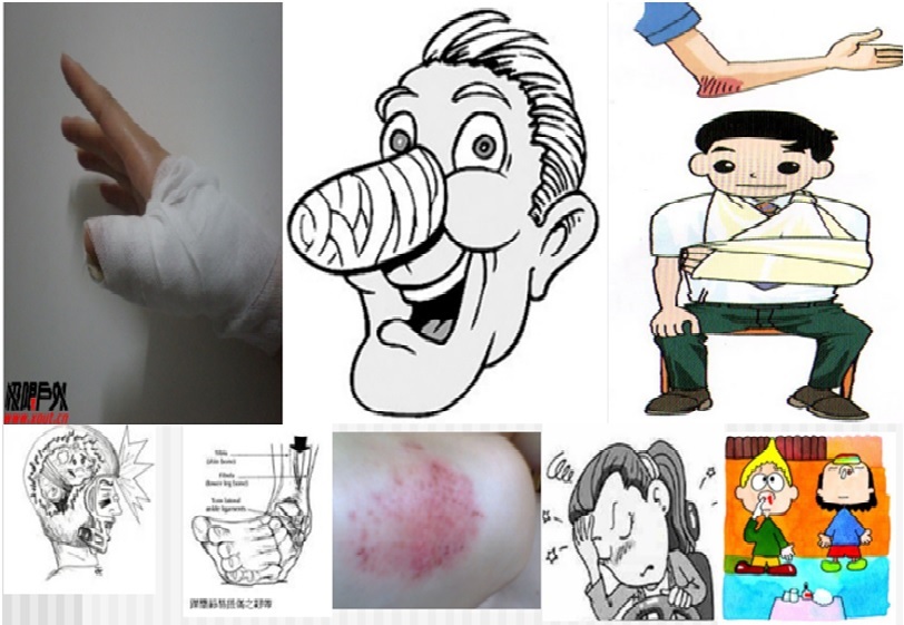 青少年常见运动伤害的处理方式,儿童常见运动损伤的正确处理