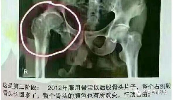 乐利来是合法直销吗,乐利来是正规直销吗