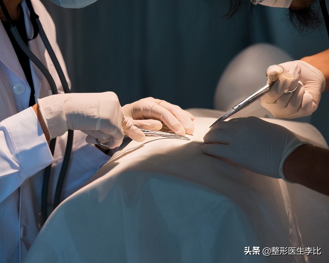 人体原本有多少乳房,人体有几个乳腺