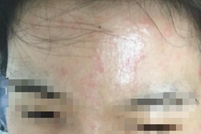 a醇视黄醇哪个抗老效果好,a醇视黄醇十件套