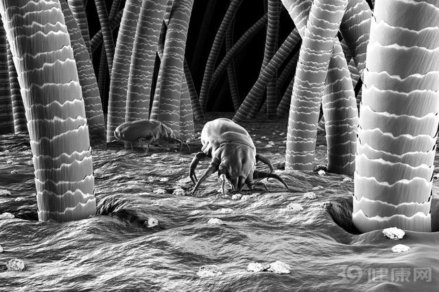 螨虫除不干净怎么办,螨虫如果不及时清理的话会怎样