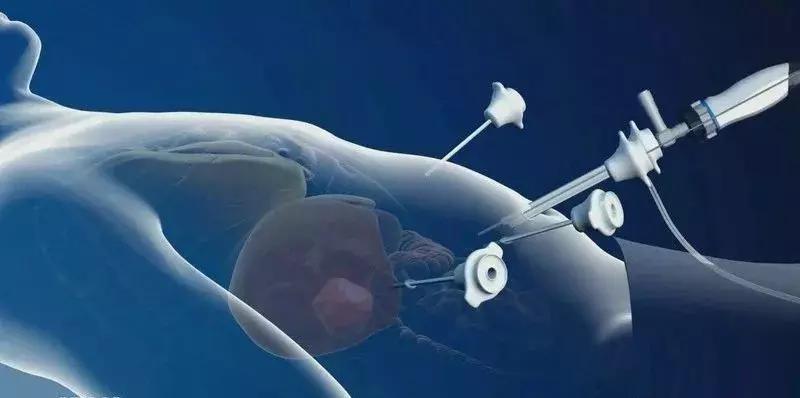 发现肝部有小结节用治疗吗,发现肝脏结节要做哪些检查