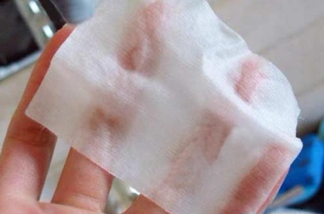 如何彻底消灭在痘痘里的螨虫,痘痘里面有米粒怎么全部去除