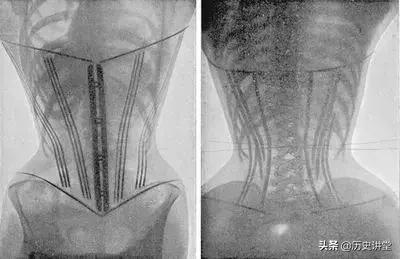 历史上那些审美陋习,古代病态审美束腰裹脚