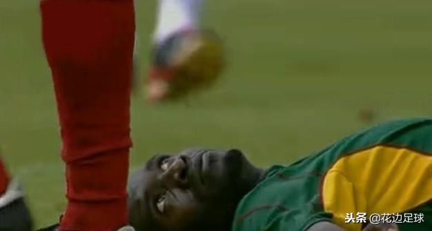 盘点那些球星患有的怪病（下）