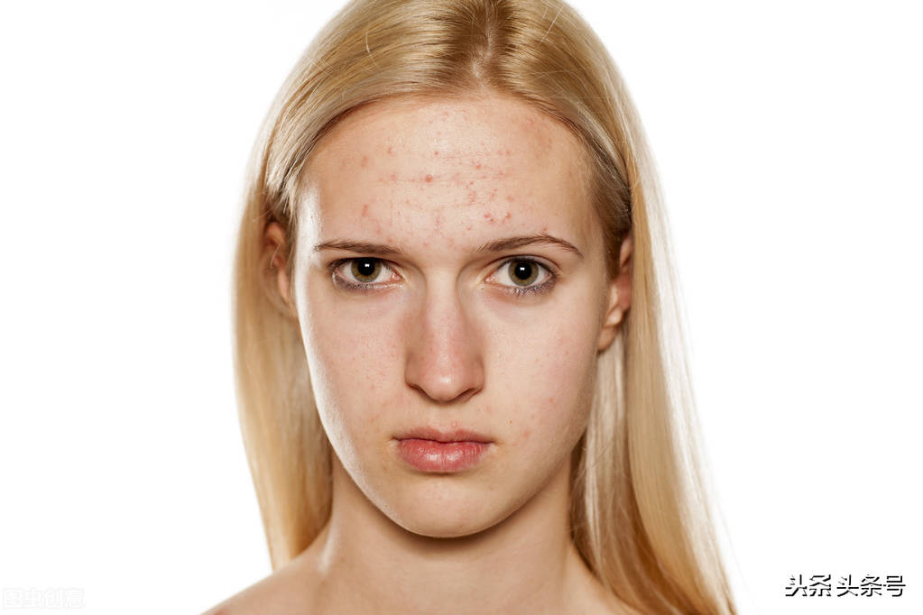 随着年龄增长人脸皮肤会变粗糙,人脸皮肤组织示意图