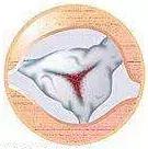 心脏使用说明及保养,心脏用药记忆口诀