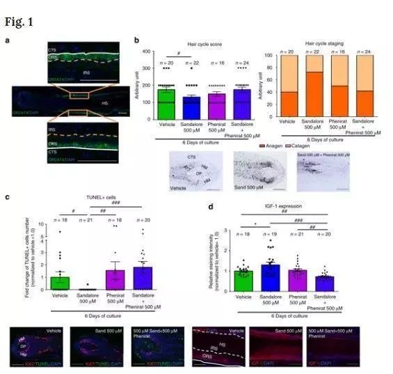 90后“未富先秃”！该拿什么拯救我的发际线？