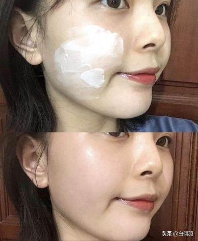 全球公认最有效的祛痘印产品,公认祛痘印最好的产品是什么