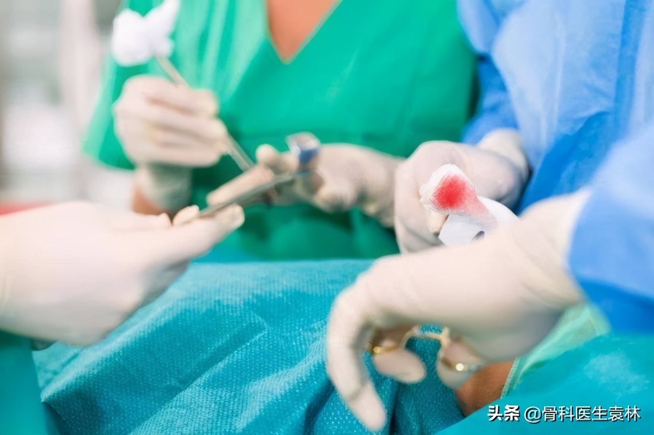 髋关节骨性关节炎怎么治疗效果好,髋关节骨性关节炎怎么治