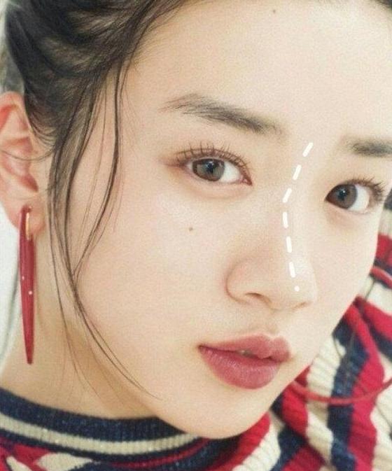 塌鼻子蒜头鼻瘦下来能好看吗,塌鼻梁蒜头鼻侧脸为什么会很丑