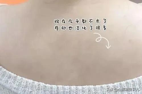 床单久睡不晒螨虫“成堆”？教你1招，不用洗不用晒，轻松除螨虫