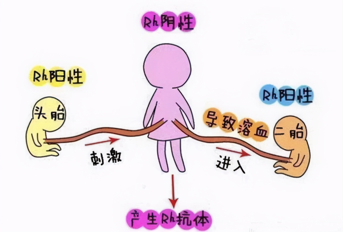 母婴血型不合新生儿溶血病,母婴血型相克