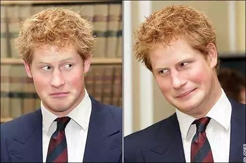 90后“未富先秃”！该拿什么拯救我的发际线？