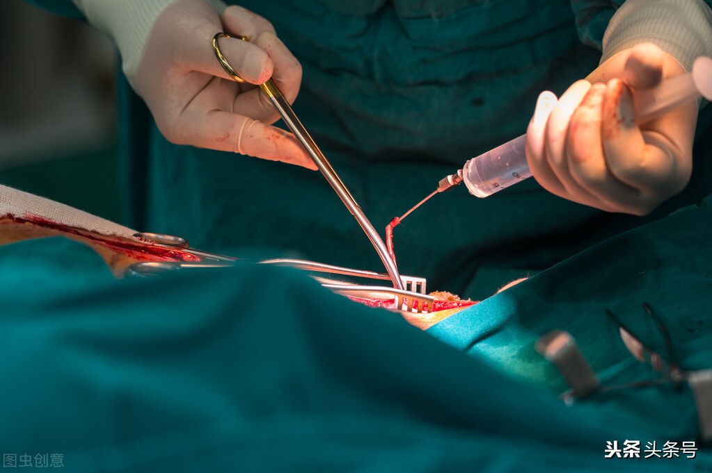 难产大出血孩子没保住,生宝宝大出血难产死活不出来