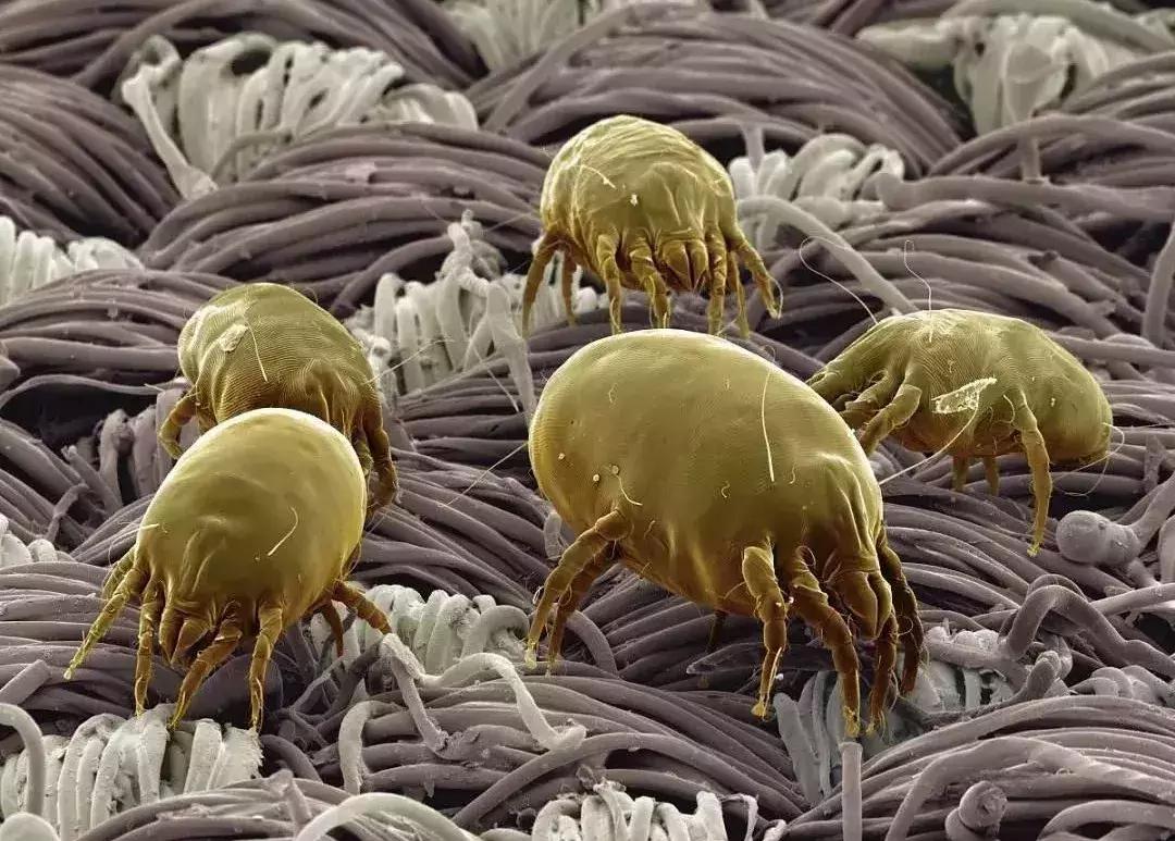 尘螨叮咬怎么治疗,螨虫叮咬传播疾病