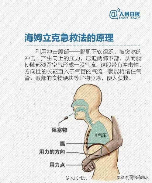 食物卡喉怎么办教你正确急救法,上呼吸道卡住异物怎么办