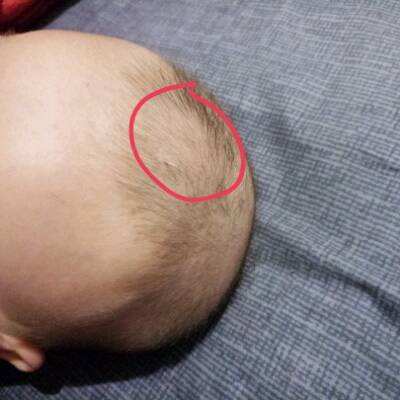 宝宝3岁总是不自觉摸脸摸头,宝宝总是急躁乱抓是什么原因