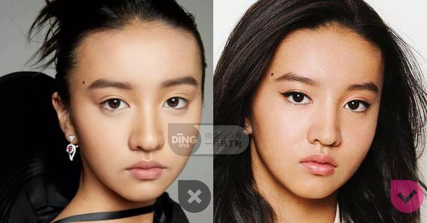 戴牙套凸嘴怎么化妆,凸嘴整牙削骨吗