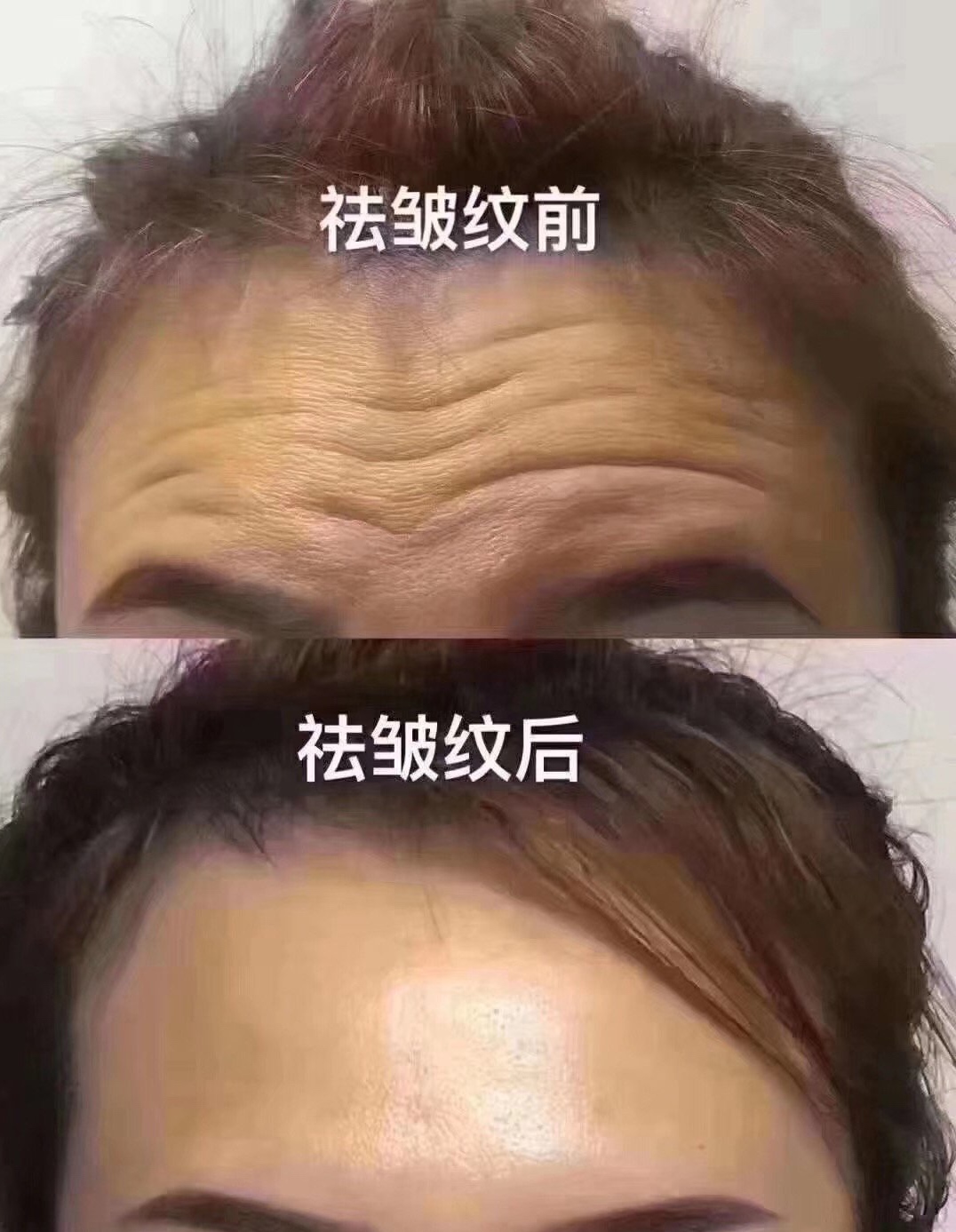 名门泽佳眼袋怎么保护,名门泽佳洗脸的正确方法