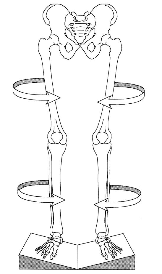 孩子有点内八字怎么矫正,一招解决儿童内八字