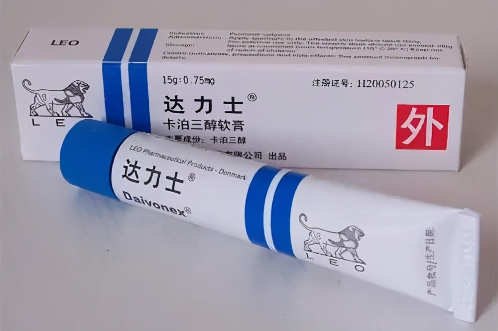 了解常见皮肤病之银屑病,西医怎样治银屑病