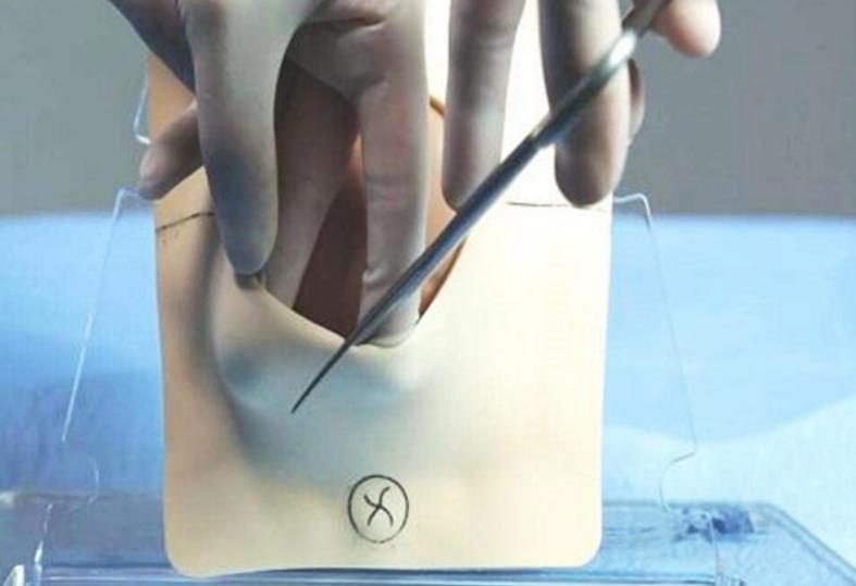 为什么很多孕妇选择剖腹产,比顺产更让孕妈担心的是侧切